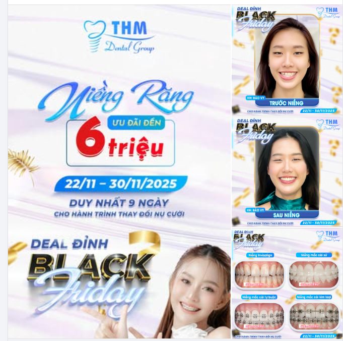 BLACK FRIDAY 2025 – DEAL “ĐỈNH” CHO HÀNH TRÌNH THAY ĐỔI NỤ CƯỜI