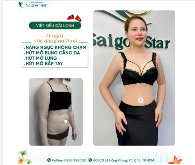 KHÁCH VIỆT KIỀU ĐÀI LOAN KHOE BODY NUỘT NÀ SAU 14 NGÀY "ĐỘ DÁNG" CÙNG DR. HOẠT