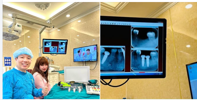 Khách hàng Thu Thảo – Việt kiều Đức tin chọn Nha khoa Hải Đăng trồng 3 trụ Implant Thuỵ Sĩ