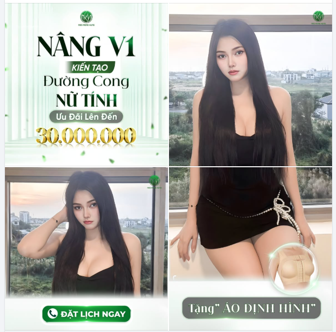 Nâng V1 kiến tạo đường cong nữ tính  Ưu đãi lên đến 30 triệu