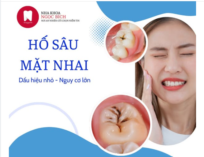 HỐ SÂU MẶT NHAI - DẤU HIỆU NHỎ , NGUY CƠ LỚN!