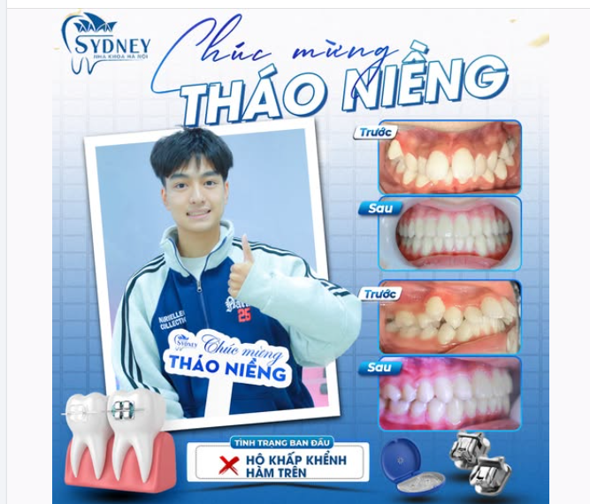 THÁO NIỀNG RĂNG - NÂNG TẦM DIỆN MẠO, MỞ LỐI TƯƠNG LAI