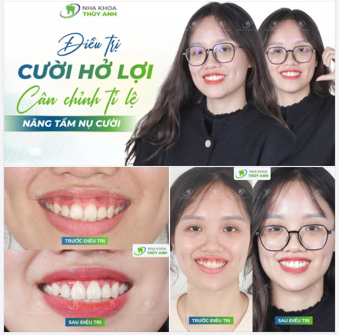 GIÁNG SINH GẦN VỀ, CƯỜI XINH CŨNG VỀ GẦN