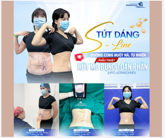 TÚT DÁNG S-LINE – ĐƯỜNG CONG NUỘT NÀ, TỰ NHIÊN