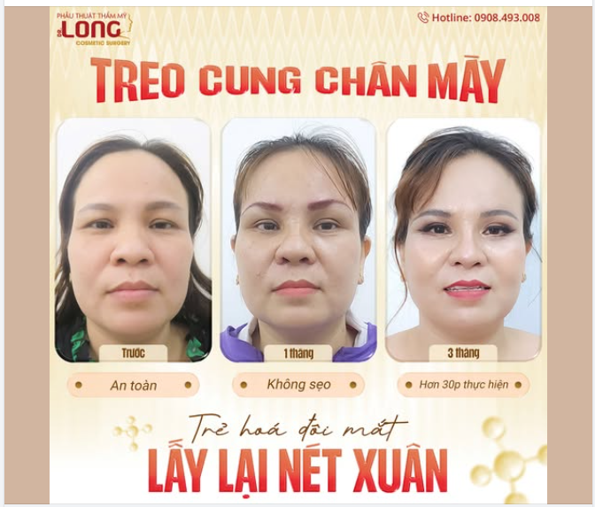 Làm tới đâu trẻ tới đó!  Đừng để đôi mắt “xuống cấp” khiến bạn đánh mất chính mình.