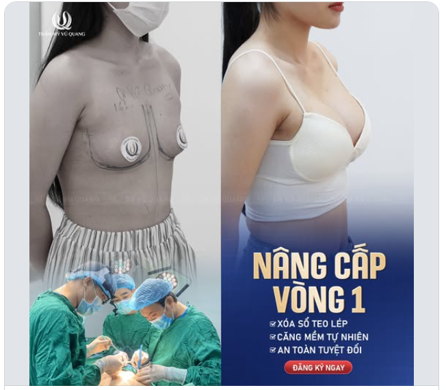 Nếu V1 của bạn đang....lép....thì đây là tín hiệu vũ trụ muốn gửi đến bạn