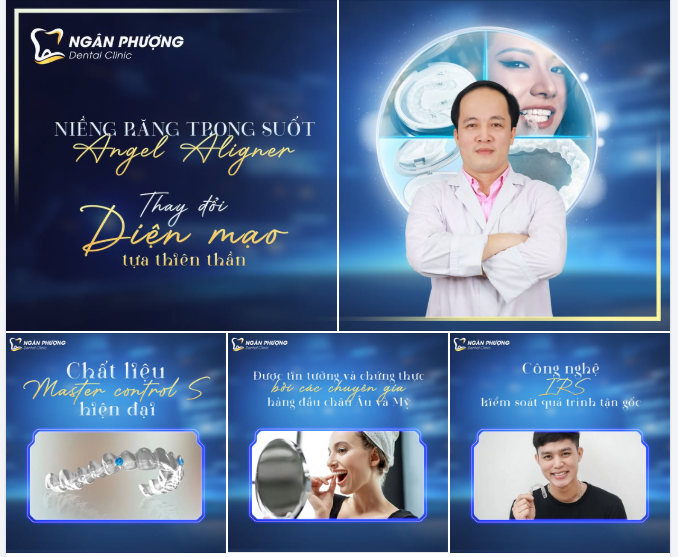 NIỀNG TRONG SUỐT RẺ HƠN MẮC CÀI