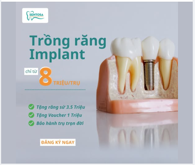 TRỒNG RĂNG IMPLANT CHỈ TỪ 8 TRIỆU – ĂN NGON, CƯỜI ĐẸP, KHÔNG LO MẤT RĂNG