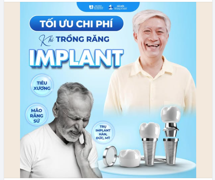 TRỒNG RĂNG IMPLANT – TỐI ƯU CHI PHÍ THẾ NÀO ĐỂ KHÔNG “ĐAU VÍ”?