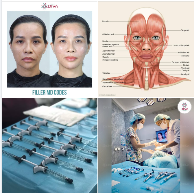 CẢI THIỆN TÌNH TRẠNG KHÓE MŨI MIỆNG SÂU ĐÚNG CÁCH - HIỆU QUẢ NHƯ THẾ NÀO?