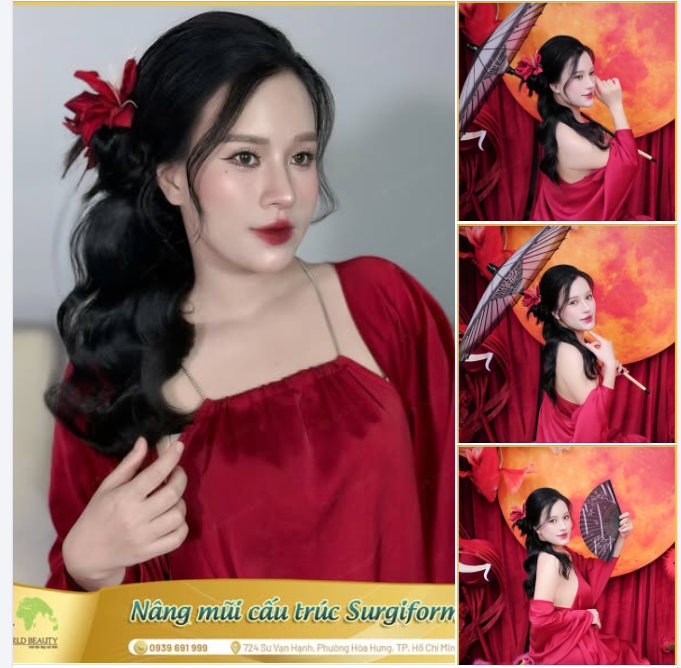 Sở hữu dáng mũi Barbie-line không chỉ làm tôn lên vẻ đẹp thời thượng, gương mặt thanh thoát mà còn là “thước đo” sự tinh tế trong lựa chọn nâng cấp dung mạo.