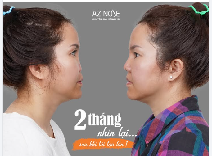 Không dùng Photoshop để kéo dài đầu mũi