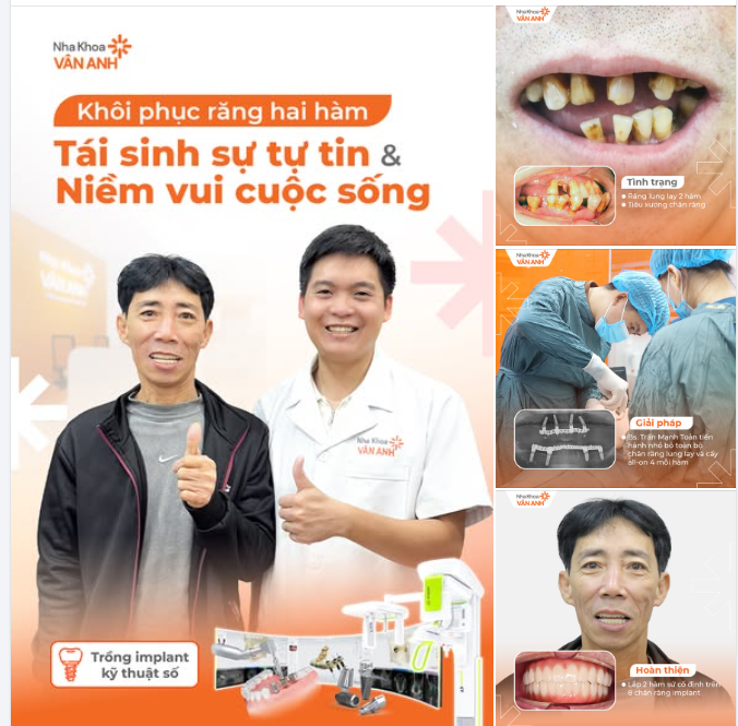 Nha khoa Vân Anh - trung tâm cấy ghép Implant Công nghệ số hàng đầu miền Bắc An toàn Không đau Cá nhân hoá