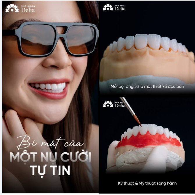 Bí mật của một nụ cười tự tin – nơi mỗi bộ răng sứ là một thiết kế độc bản