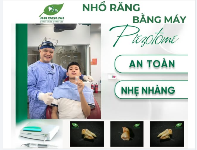 NHỔ RĂNG BẰNG MÁY PIEZOTOME – AN TOÀN, NHẸ NHÀNG, KHÔNG ĐAU