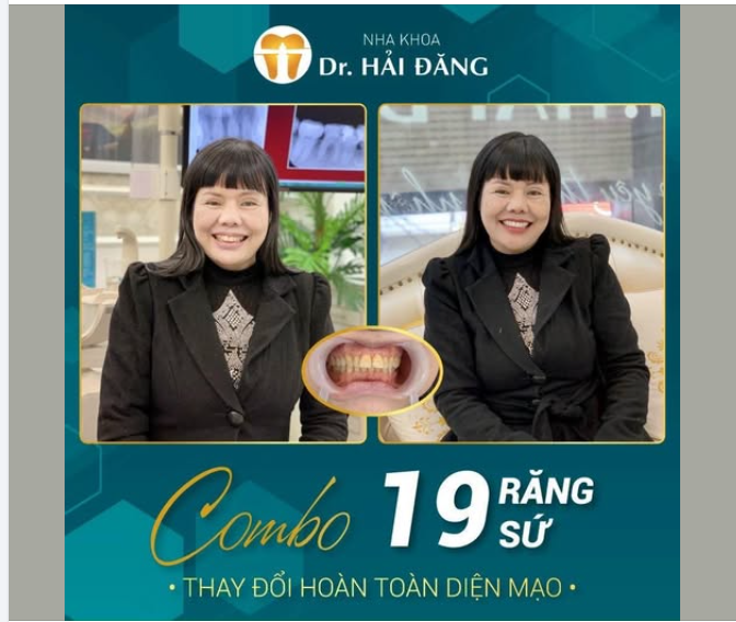 THAY NỤ CƯỜI - THAY ĐỔI DIỆN MẠO