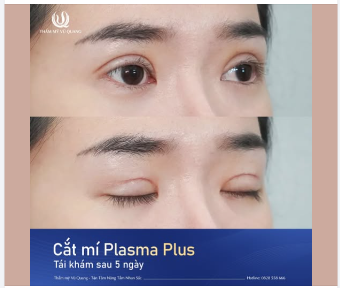 MÍ SIÊU NÉT – TỰ NHIÊN NHƯ KHÔNG CAN THIỆP – CHỈ 30 PHÚT