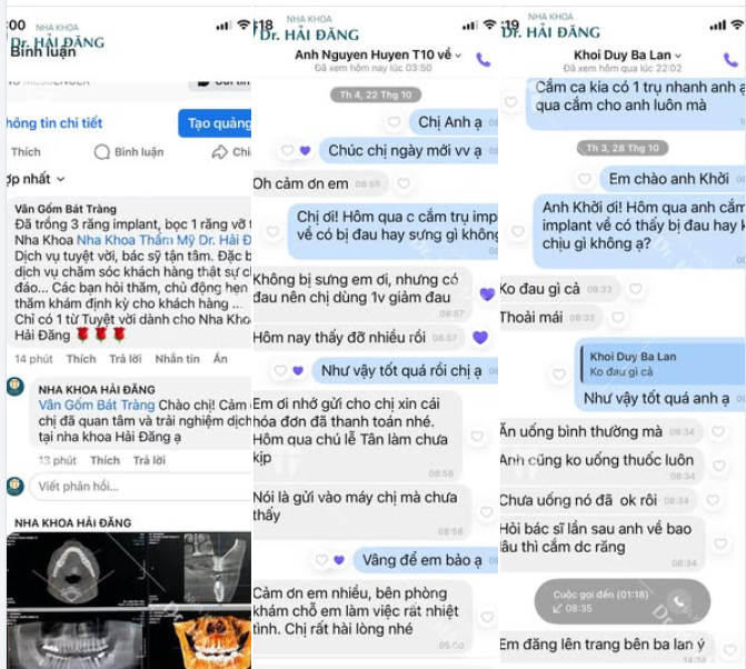 CẢM ƠN KHÁCH HÀNG ĐÃ TIN TƯỞNG DỊCH VỤ IMPLANT TẠI NHA KHOA HẢI ĐĂNG