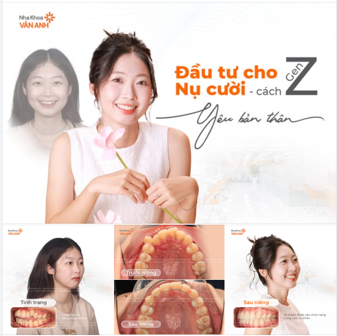 GEN Z KHÔNG CHỈ GIỎI KIẾM TIỀN – MÀ CÒN BIẾT QUAN TÂM BẢN THÂN ĐÚNG CÁCH!