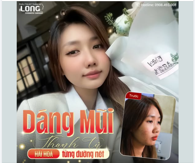 Nâng mũi gì chưa người đẹp.