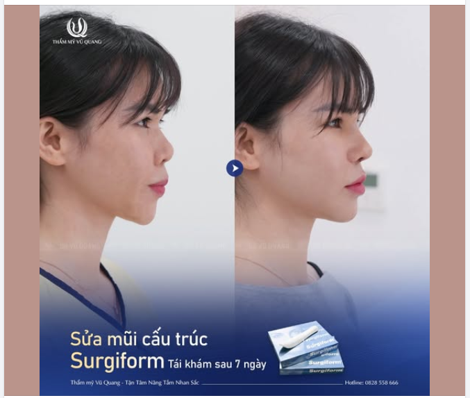 7 NGÀY CẮT CHỈ - TƯỞNG CHƯA ĐẸP MÀ LẠI...ĐẸP KHÔNG TƯỞNG!
