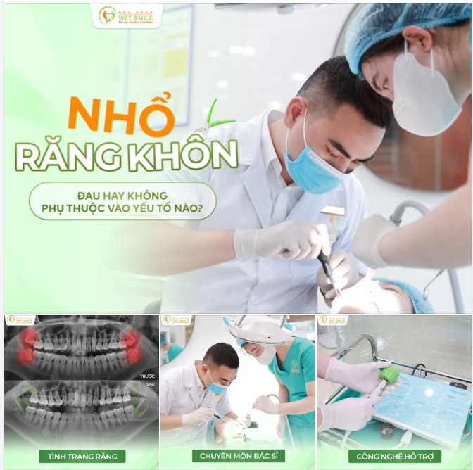 NHỔ RĂNG KHÔN – ĐAU HAY KHÔNG? LỜI GIẢI MÃ
