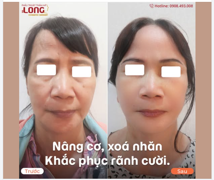 SAU THỜI GIAN TRÔI QUA NHANH THẾ  Sau hôm nay thấy mình trong gương lại khác lạ nhiều đến vậy