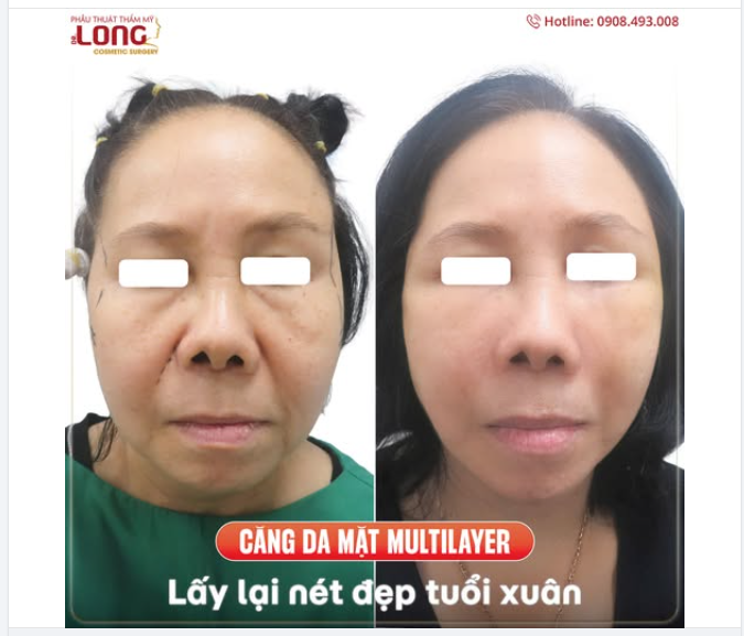 DÙ LÀ XUÂN HẠ THU HAY ĐÔNG THÌ CHỊ EM VẪN LUÔN SỢ...