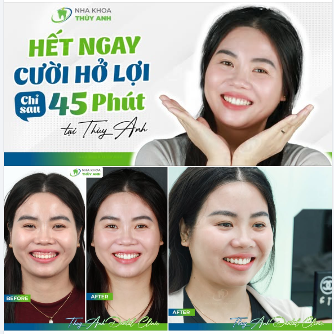 CUỐI NĂM RỰC RỠ – NỤ CƯỜI HOÀN HẢO CHUẨN TỈ LỆ CHỈ TRONG 45 PHÚT!