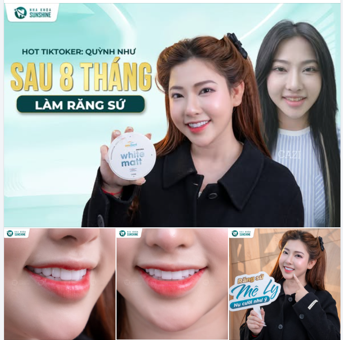 Minh chứng rõ nhất về chất lượng dòng răng sứ cao cấp nhất hiện nay: Orodent – thương hiệu đến từ Ý