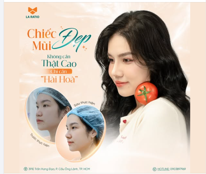 CHIẾC MŨI ĐẸP – KHÔNG CẦN THẬT CAO, CHỈ CẦN HÀI HOÀ