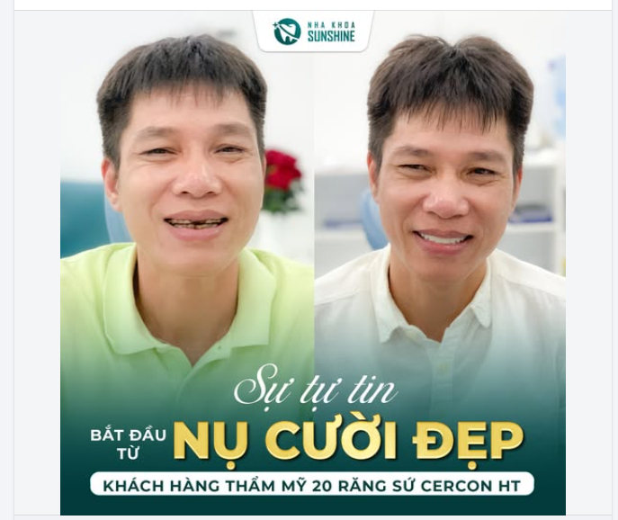 Đàn ông không cần quá nhiều thứ để tạo ấn tượng, chỉ cần nụ cười sáng và tự tin là đã khác biệt rồi 