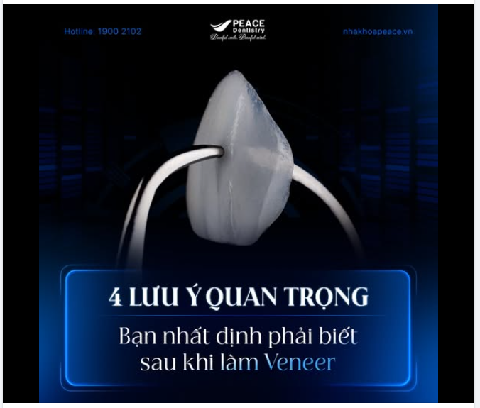 ĐẸP LÀ CHƯA ĐỦ, PHẢI "BỀN"! 4 ĐIỀU CẦN BIẾT ĐỂ BẢO VỆ NỤ CƯỜI MỚI