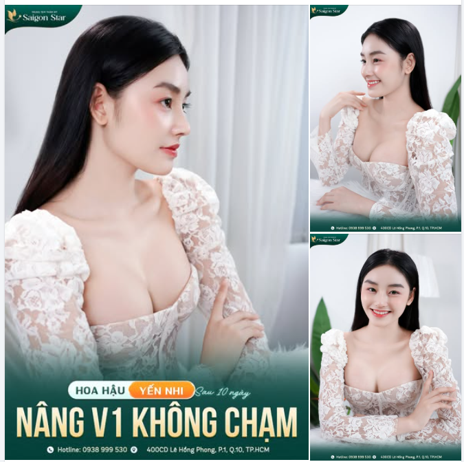 HOA HẬU YẾN NHI TÁI XUẤT RẠNG RỠ – VÒNG 1 QUYẾN RŨ CHỈ SAU 10 NGÀY “NÂNG CẤP”