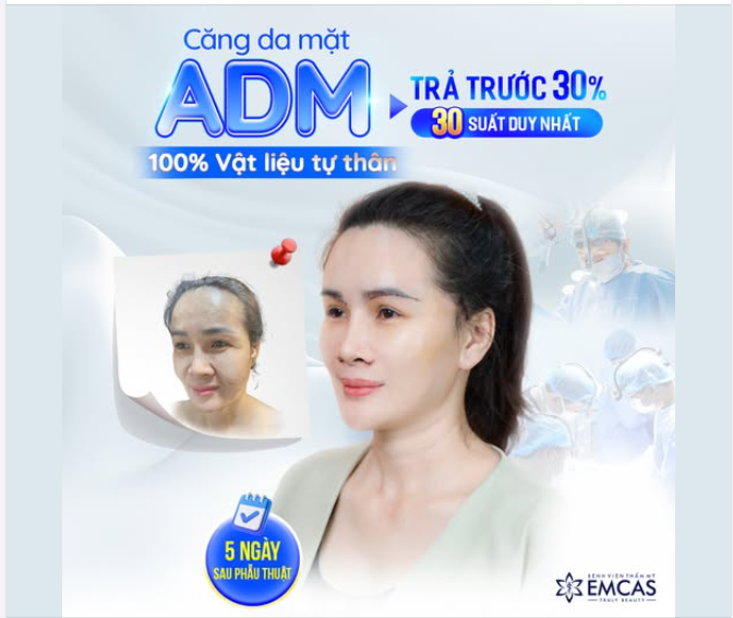 CĂNG DA MẶT ADM - 100% Vật liệu tự thân