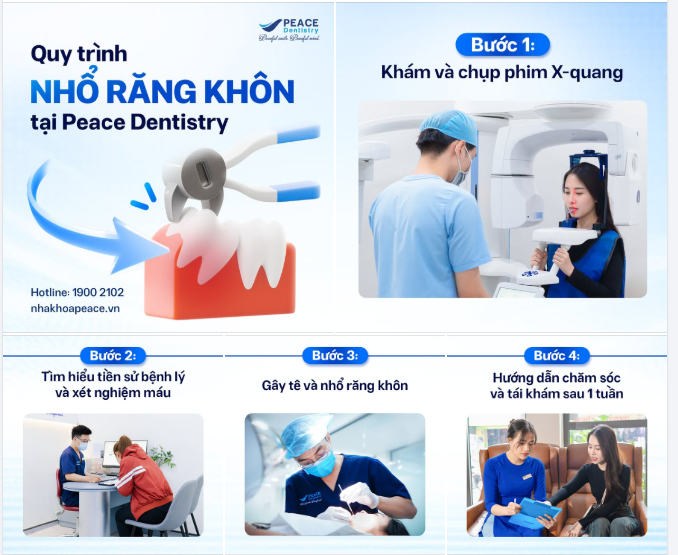 NHỔ RĂNG KHÔN AN TOÀN - KHÔNG BIẾN CHỨNG