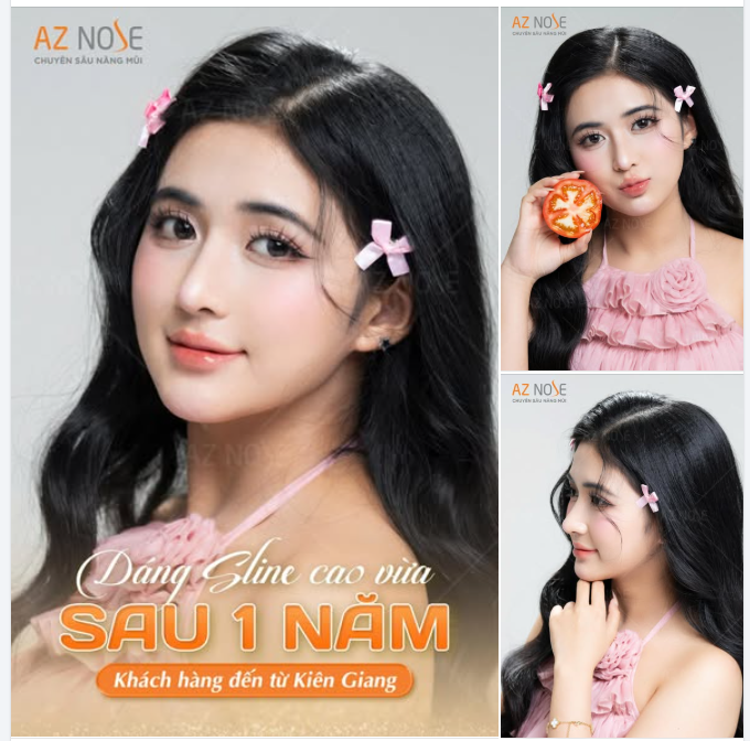 GenZ Kiên Giang gây thương nhớ với nét trong trẻo, ngọt ngào sau 1 năm nâng mũi