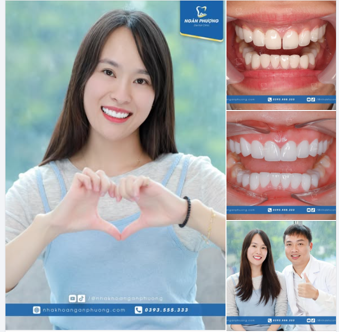 Nụ cười mười phân vẹn mười cho chị Lê Phương