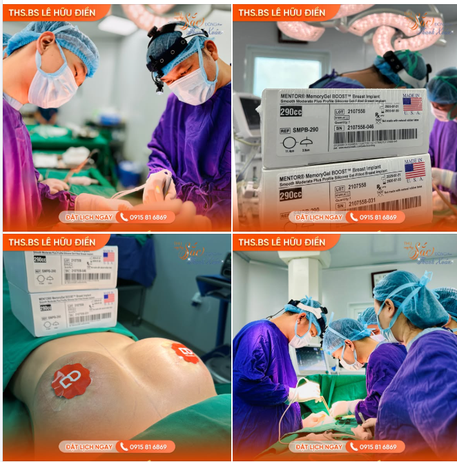 Chị M nhân viên Ngân Hàng - Một trong những khách hàng đầu tiên chọn Túi Mentor Boost vừa hoàn tất phẫu thuật hôm nay