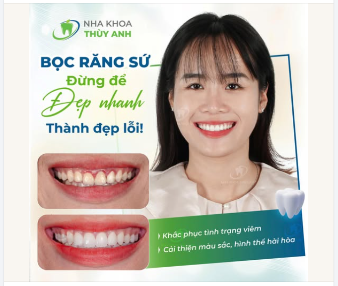 ''BỌC SỨ ĐỂ TỰ TIN HƠN NHƯNG ĐÃ CÓ NHỮNG LÚC EM KHÔNG DÁM NỞ NỤ CƯỜI''