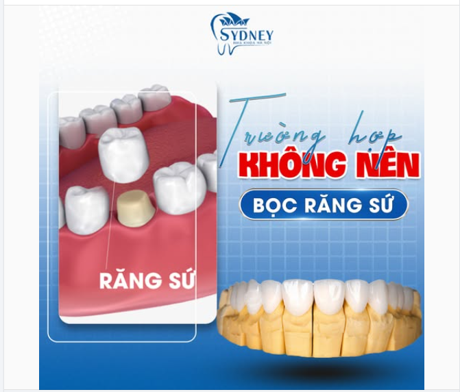 NHỮNG TRƯỜNG HỢP KHÔNG NÊN BỌC RĂNG SỨ