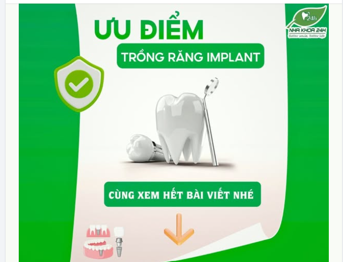TRỒNG RĂNG IMPLANT - GIẢI PHÁP PHỤC HỒI RĂNG VƯỢT TRỘI