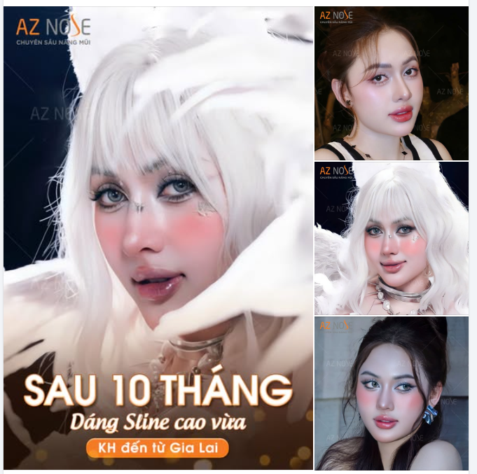 Tự tin thể hiện phong cách riêng với dáng mũi Sline sau 10 tháng