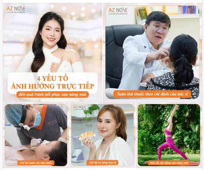 4 YẾU TỐ ẢNH HƯỞNG ĐẾN QUÁ TRÌNH HỒI PHỤC SAU NÂNG MŨI