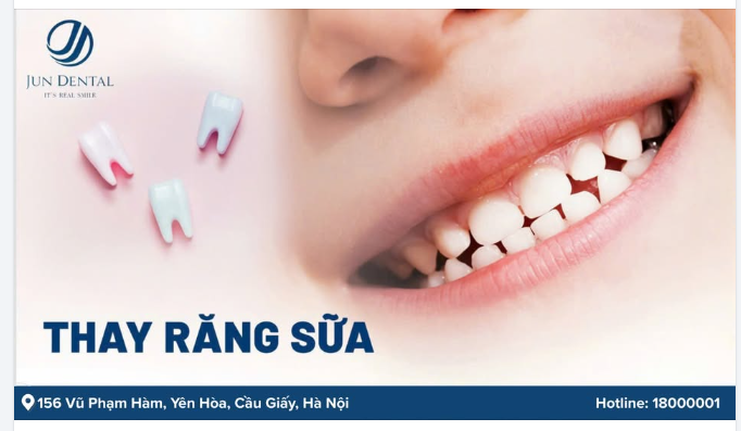 Răng sữa lung lay – Nên nhổ hay chờ rụng tự nhiên?