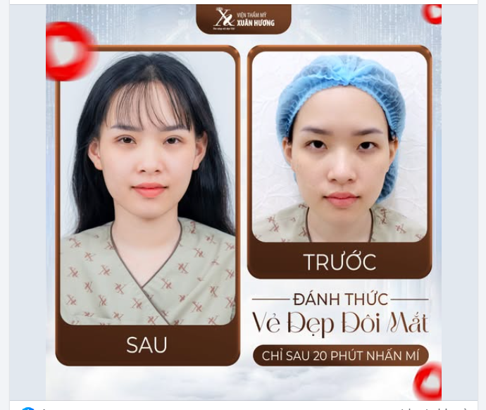 ĐÁNH THỨC VẺ ĐẸP ĐÔI MẮT CHỈ SAU 20 PHÚT NHẤN MÍ