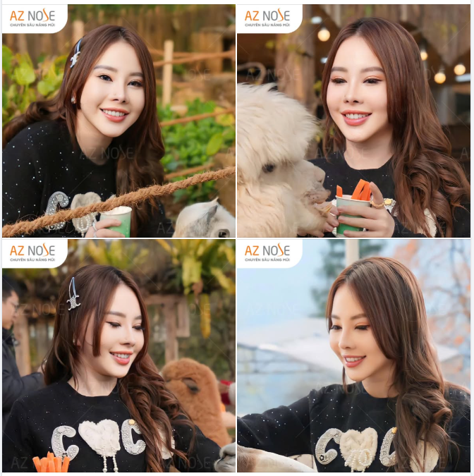 Thành quả của Cô Đồng Hà Thành sau 3 năm từ Hà Nội đến AZ NOSE tái tạo mũi hỏng