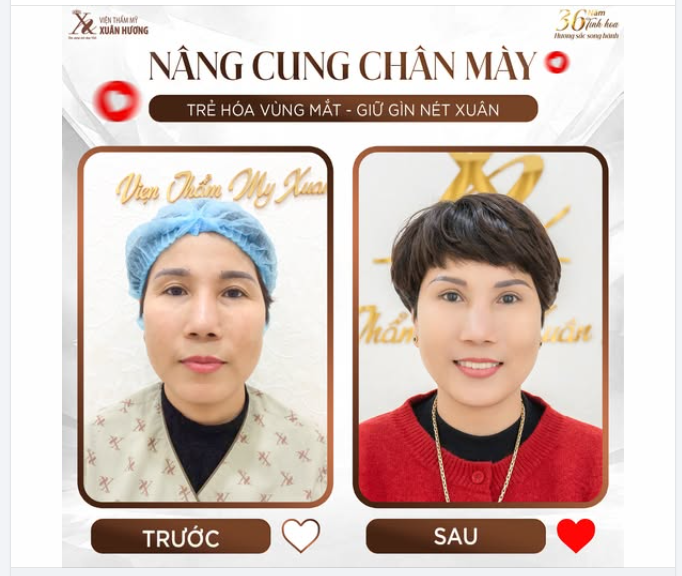 GIỮ GÌN NÉT XUÂN VỚI COMBO NÂNG CUNG PHUN XĂM CHÂN MÀY