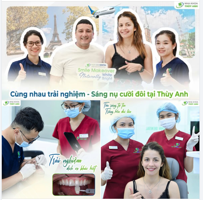 NHÂN ĐÔI RẠNG RỠ CHO CẶP ĐÔI PHÁP SAU LIỆU TRÌNH TẨY TRẮNG RĂNG