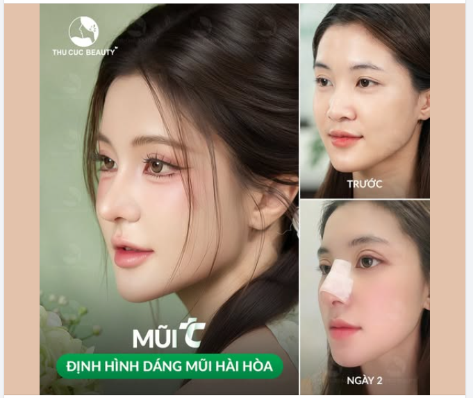 Thay đổi dáng mũi. Thay đổi diện mạo